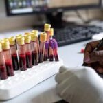 HIV jab for 115 nations rests on Indian regulators