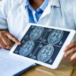 Alert: Neurological disorders now affect 40% of people