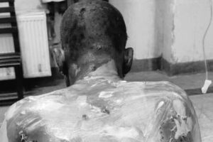 ‘Just let me see my son’: Kashmir father who self-immolated after denial to meet detained son dies of burns