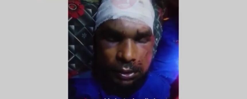 Muslim labourer assaulted in Bihar after being labelled “Bangladeshi”