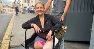 How Venezuela’s earthquake amputees adapt to life without limbs